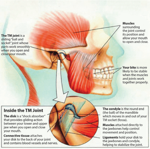 TMD Treatment Options for Jaw Relief